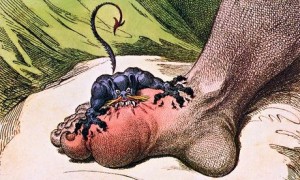 The Gout: an 18th-century cartoon by James Gillray depicts the agony induced by the condition. Photograph: Lordprice Collection/Alamy