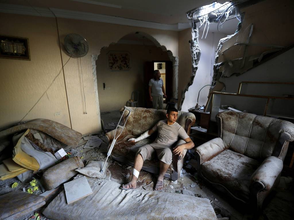 An injured Palestinian man from the Al-Elaa family sits inside his house after it was hit by an Israeli military strike in the Jabalia refugee camp, in the northern Gaza Strip