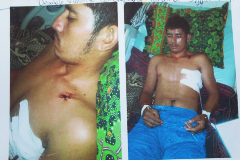 Photos supplied by the Panamá community documenting injuries suffered by peasants when Honduran soldiers expelled them from an occupation of Dinant’s Paso Aguán plantation in July 2014. International Consortium of Investigative Journalists