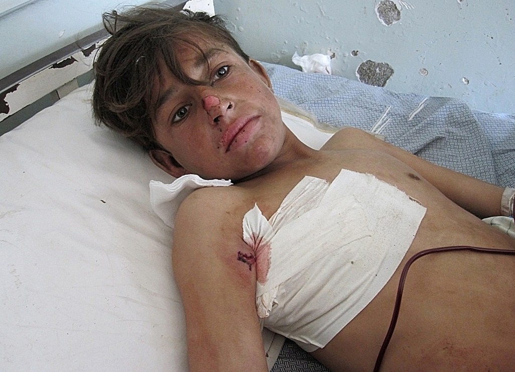 A wounded Afghan boy receives treatment at a hospital in Kunar province on Feb. 13, 2013, after a NATO airstrike killed 10 civilians. Photo: Namatullah Karyab/AFP/Getty Images