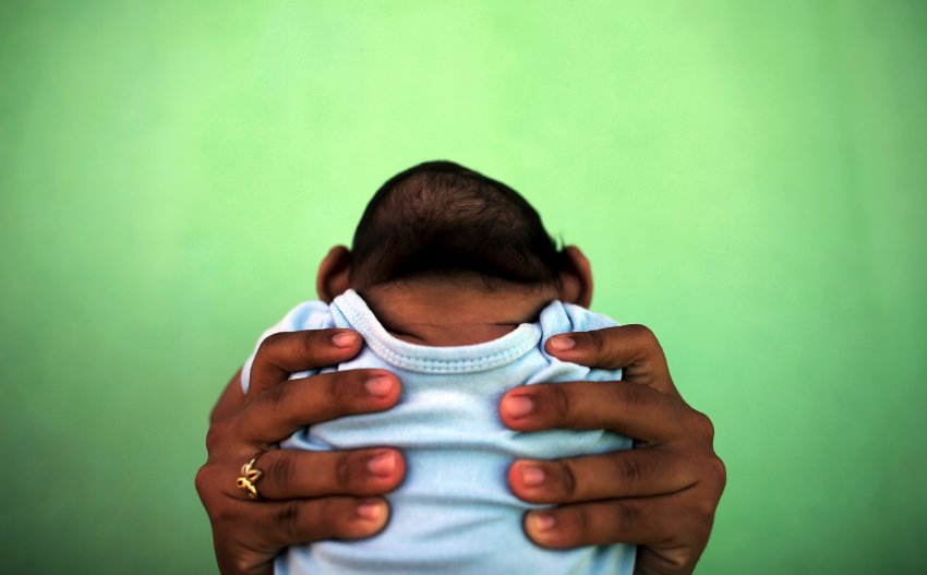 Zika has spread across Brazil in recent months, raising fears ahead of the Olympic Games, set to start in two weeks. An increase in the number of microcephaly cases, as seen in this image of a four-month old baby near Recife, Brazil, is apparently linked to the Zika virus.